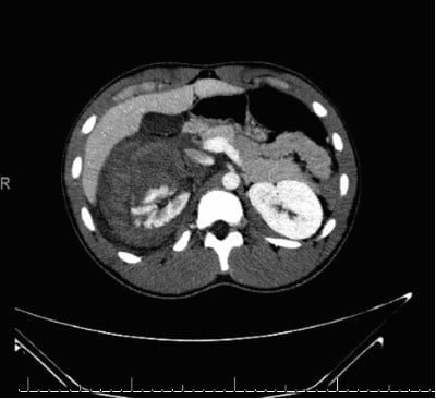 Kidney Figure 2.jpg