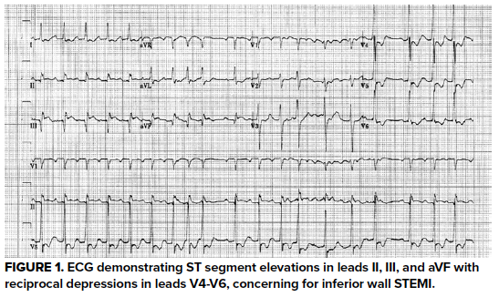 Point-of-care Echocardiography in the Undifferentiated Patient: A Case ...