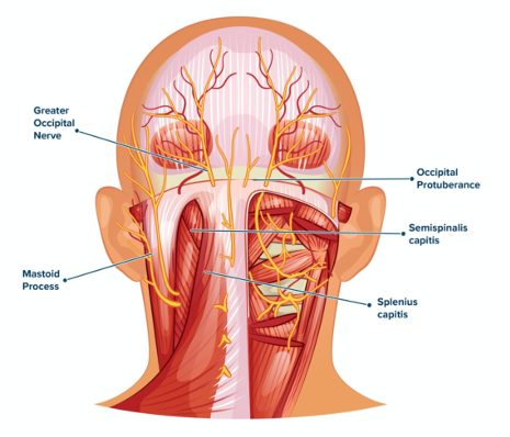Migraine medications: Video, Anatomy & Definition