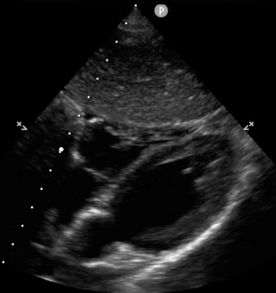 POCUS Figure 10 SX Ultrasound.png