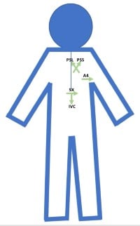 POCUS Figure 2 Anatomic Sites.jpg