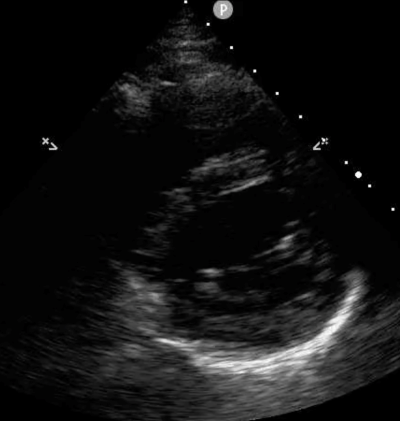 POCUS Figure 6 PSS Ultrasound.png