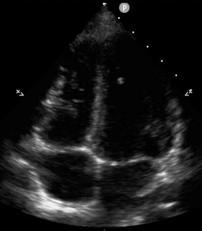 POCUS Figure 8 A4 Ultrasound.png