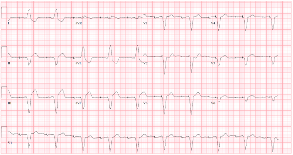 ECG Challenge Case Photo.png