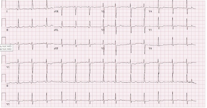 Cardiac Arrest Figure 1.jpg