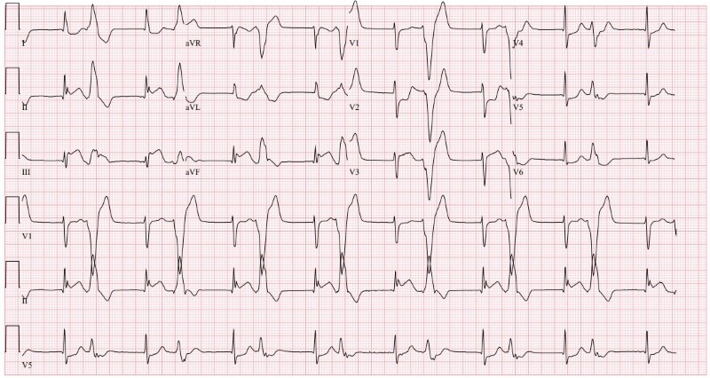 Cardiac Arrest Figure 2.jpg