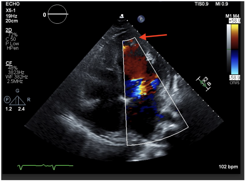 Cardiomyopathy Image 2.png