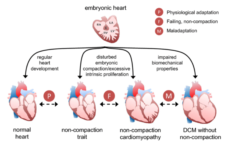 Cardiomyopathy Image 3.png