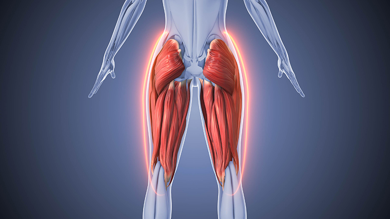 Gluteal Compartment Syndrome web.jpg