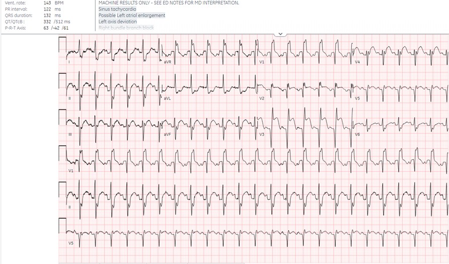 POCUS FTW Septum Image 1.jpeg