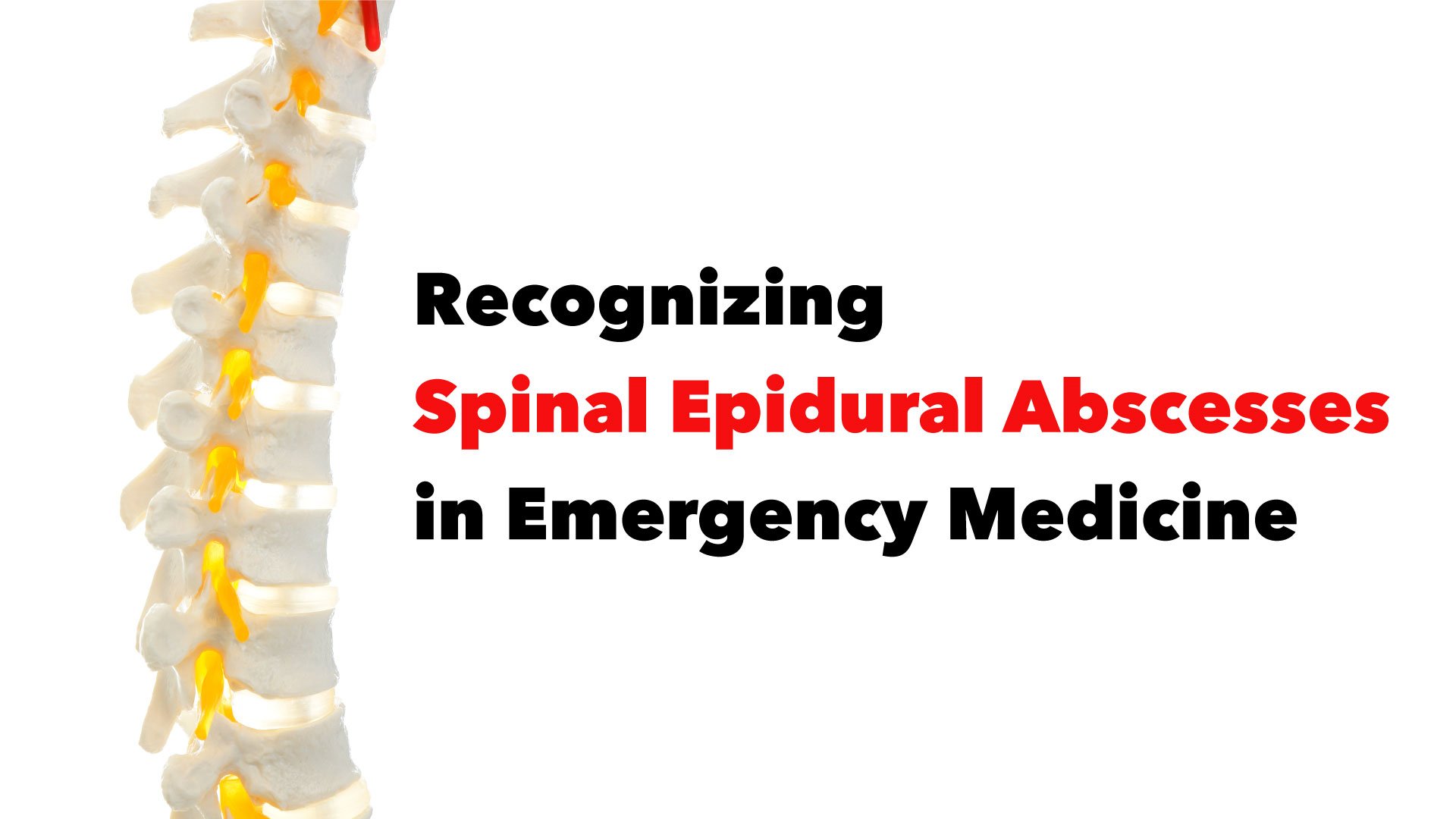 Spinal Epidural Abscess - suggested heading.jpg