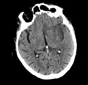 Cardiogenic Syncope Image 1.jpg