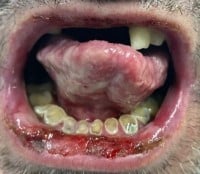 Behcet Figure 1 Oral Lesions.jpeg